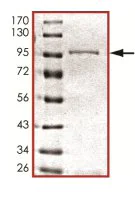 SDS-PAGE - Recombinant Human PADI6 protein (AB126915)