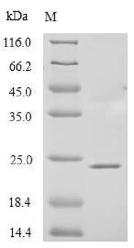 SDS-PAGE - Recombinant Human PAEP/Glycodelin protein (Tagged) (AB239575)