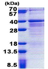 SDS-PAGE - Recombinant Human PAG608 protein (AB167842), expandable thumbnail