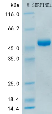 SDS-PAGE - Recombinant Human PAI1 Protein Standard (His tag) (AB316380)