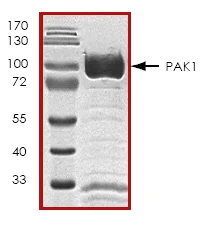 SDS-PAGE - Recombinant Human PAK1 protein (AB45162)