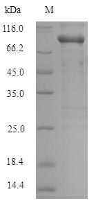 SDS-PAGE - Recombinant Human PAK1 protein (Tagged) (AB238241), expandable thumbnail