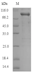 SDS-PAGE - Recombinant Human PAK1 protein (Tagged) (AB238241)