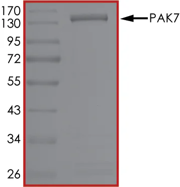 SDS-PAGE - Recombinant human PAK5 protein (GST tag N-Terminus) (AB60754)