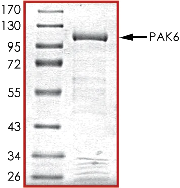 SDS-PAGE - Recombinant human PAK6 protein (AB89757)
