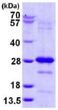 SDS-PAGE - Recombinant Human Pallidin protein (His tag N-Terminus) (AB124579)