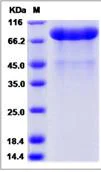 SDS-PAGE - Recombinant Human PAM/Peptidyl-glycine alpha-amidating monooxygenase protein (His tag) (AB276567)