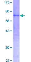 SDS-PAGE - Recombinant Human Pancreatic alpha amylase protein (GST tag N-Terminus) (AB157887)