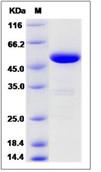 SDS-PAGE - Recombinant Human Pancreatic Lipase/PTL protein (His tag) (AB276560), expandable thumbnail