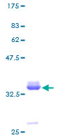 Recombinant Human Pancreatic Polypeptide protein