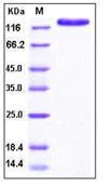 SDS-PAGE - Recombinant Human PANG protein (His tag) (AB276218)