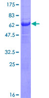 SDS-PAGE - Recombinant Human PANK1 protein (AB153362), expandable thumbnail