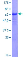 SDS-PAGE - Recombinant Human PANK1 protein (AB153362)
