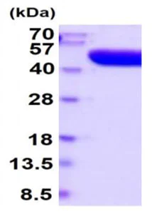SDS-PAGE - Recombinant human PAP protein (Active) (His tag C-Terminus) (AB219224)