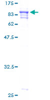 SDS-PAGE - Recombinant Human Papillary renal cell carcinoma protein (GST tag N-Terminus) (AB159181)