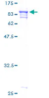 SDS-PAGE - Recombinant Human Papillary renal cell carcinoma protein (GST tag N-Terminus) (AB159181)