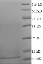 SDS-PAGE - Recombinant Human Papillomavirus 16 (E7) protein (His tag) (AB237790)