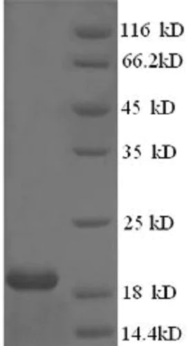 SDS-PAGE - Recombinant Human papillomavirus HPV18 E7 protein (His tag) (AB236931)