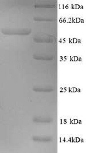 SDS-PAGE - Recombinant Human papillomavirus Minor capsid protein L2 (His tag) (AB241439)