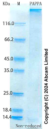 SDS-PAGE - Recombinant Human PAPPA Protein Standard (His tag) (AB316639)