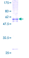 SDS-PAGE - Recombinant Human PAQR8 protein (GST tag N-Terminus) (AB164739)