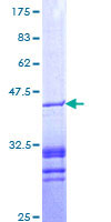 Recombinant Human PAR4 protein