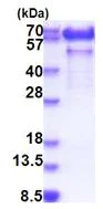 SDS-PAGE - Recombinant Human Paralemmin-1 protein (AB183171)