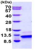 SDS-PAGE - Recombinant human Parathyroid Hormone protein (Active) (AB265858)