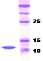 SDS-PAGE - Recombinant Human Parathyroid Hormone protein (Tag Free) (AB51234)