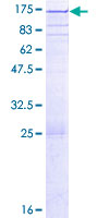 Recombinant Human PARG protein