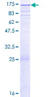 SDS-PAGE - Recombinant Human PARG protein (GST tag N-Terminus) (AB152879)