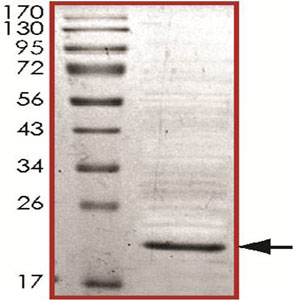 Recombinant Human PARK7/DJ1 protein