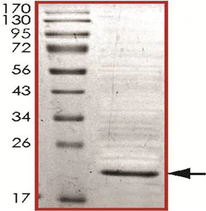 SDS-PAGE - Recombinant Human PARK7/DJ1 protein (AB140590)