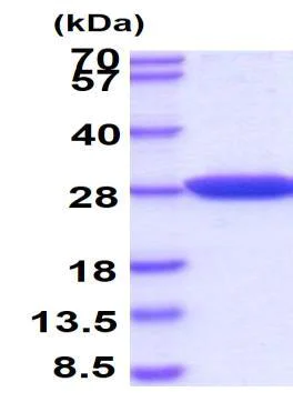 SDS-PAGE - Recombinant Human PARK7/DJ1 protein (AB51198)