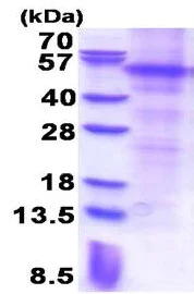 SDS-PAGE - Recombinant Human Parkin protein (denatured) (AB177625)