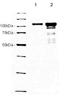 SDS-PAGE - Recombinant human PARP1 protein (AB157046)