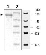 SDS-PAGE - Recombinant human PARP9 protein (AB79665)