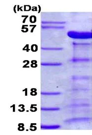 SDS-PAGE - Recombinant Human PARVA protein (AB134616)
