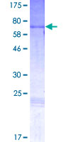 SDS-PAGE - Recombinant Human Pax2 protein (AB159050)
