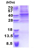 SDS-PAGE - Recombinant Human PAX9 protein (denatured) (His tag N-Terminus) (AB171496)