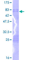 SDS-PAGE - Recombinant Human PBX2 protein (AB159055), expandable thumbnail