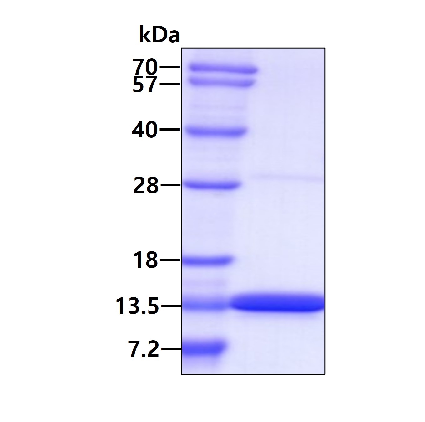 SDS-PAGE - Recombinant Human PCBD1 protein (His tag N-Terminus) (AB100942)