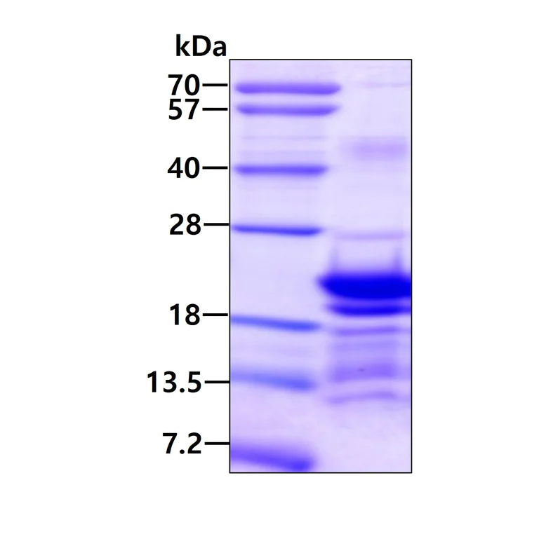 SDS-PAGE - Recombinant Human PCBP1 protein (His tag N-Terminus) (AB171681)