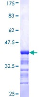SDS-PAGE - Recombinant Human PCBP2/hnRNP E2 protein (AB152593)
