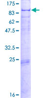 SDS-PAGE - Recombinant Human PCCA protein (AB159059)