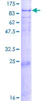 SDS-PAGE - Recombinant Human PCCA protein (GST tag N-Terminus) (AB159059)