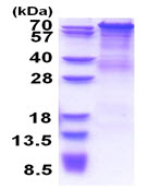 SDS-PAGE - Recombinant Human PCDHGC4 protein (denatured) (AB177673)