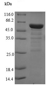 SDS-PAGE - Recombinant Human PCID1 protein (Tagged) (AB226273)