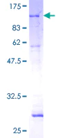 SDS-PAGE - Recombinant Human PCK2 protein (AB132473)