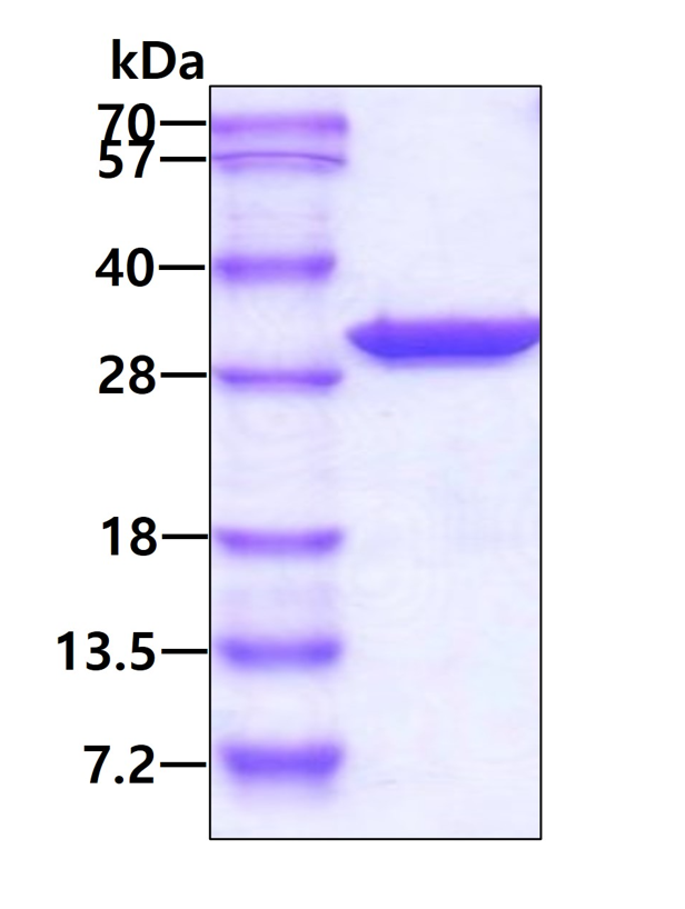 SDS-PAGE - Recombinant Human PCMT1 protein (AB95914), expandable thumbnail